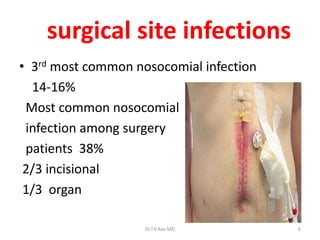 SURGICAL SITE INFECTIONS PREVENTION AND CARE | PPTX
