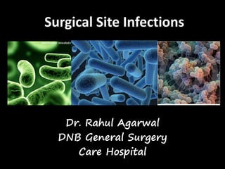 Surgical Site Infections
Dr. Rahul Agarwal
DNB General Surgery
Care Hospital
 