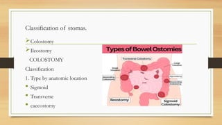 SURGICAL STOMAS presentation BMS 2026.pptx