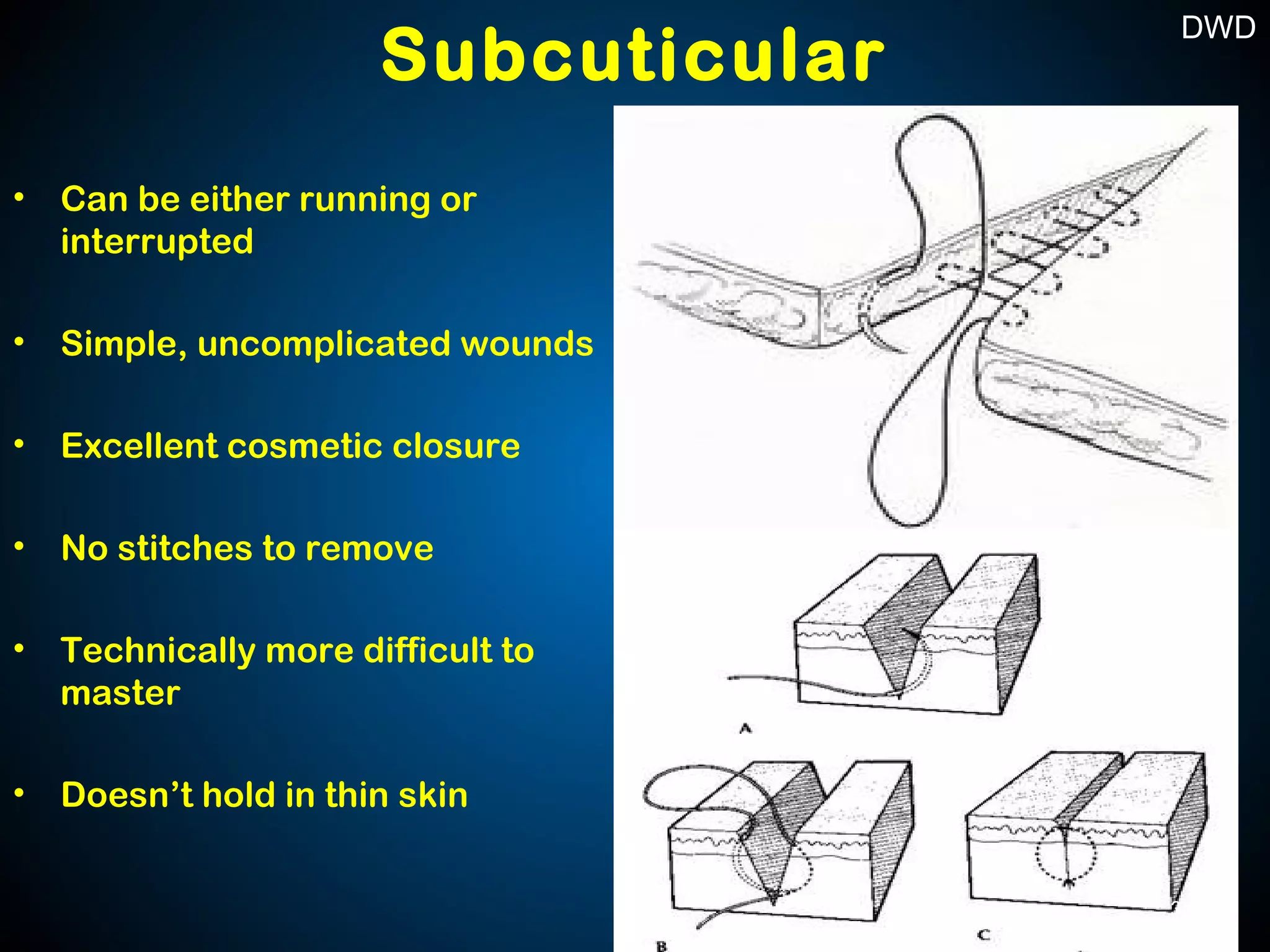 Surgical Sutures And Suturing Techniques PPT