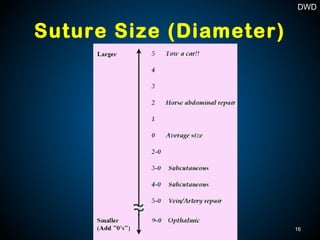Suture Size (Diameter)
16
DWD
 