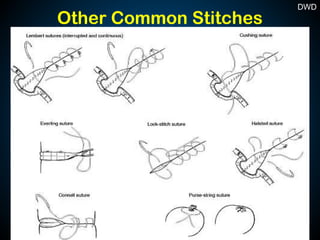Other Common Stitches
38
DWD
 