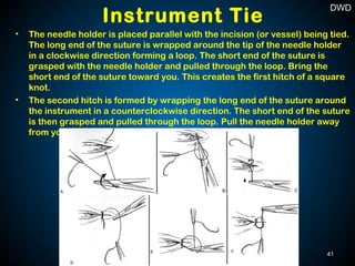 • The needle holder is placed parallel with the incision (or vessel) being tied.
The long end of the suture is wrapped around the tip of the needle holder
in a clockwise direction forming a loop. The short end of the suture is
grasped with the needle holder and pulled through the loop. Bring the
short end of the suture toward you. This creates the first hitch of a square
knot.
• The second hitch is formed by wrapping the long end of the suture around
the instrument in a counterclockwise direction. The short end of the suture
is then grasped and pulled through the loop. Pull the needle holder away
from you, squaring the knot.
Instrument Tie
41
DWD
 