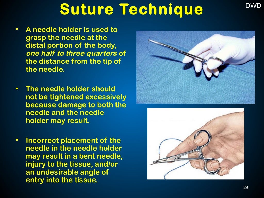 Surgical Sutures and Suturing Techniques