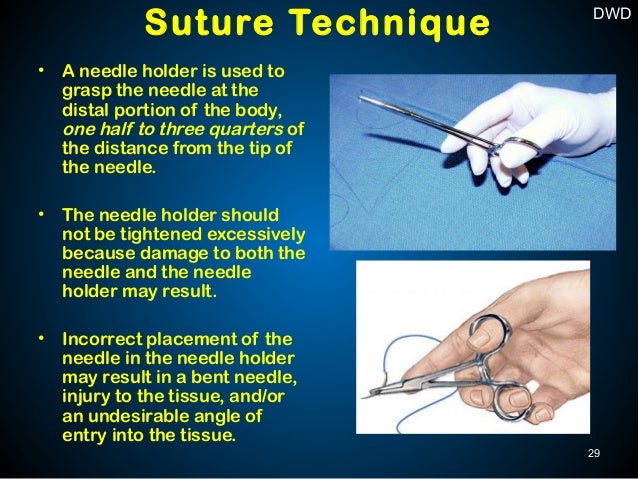 Surgical Sutures and Suturing Techniques