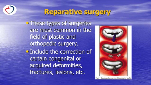 Operative Intervention Surgical terminology and types of surgical interventions.pptx