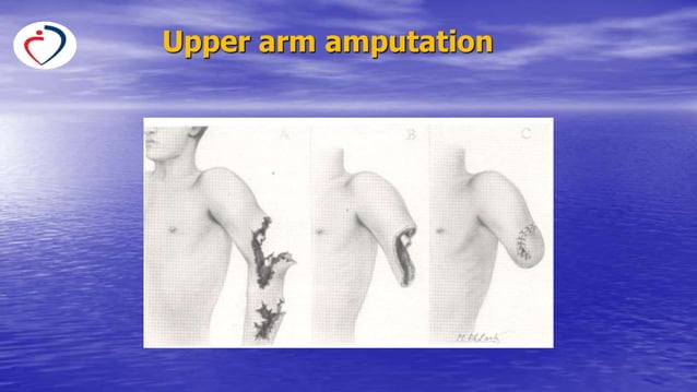 Operative Intervention Surgical terminology and types of surgical interventions.pptx