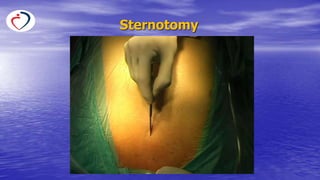 Strnotomy Surgical terminology and types of surgical interventions.pptx