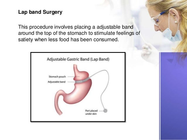 Surgical Treatment for Type 2 Diabetes