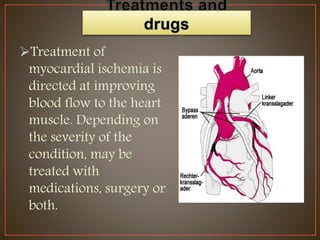 Surgical treatment of myocardial ischemia | PPTX
