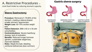 Lacking Procedure Surgical Treatment of obesity Prem Aher,511.pptx
