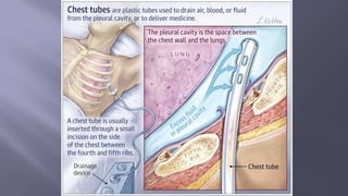Surgical Tubes used in General Surgery