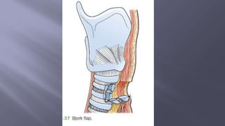 Surgical Tubes used in General Surgery