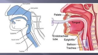 Surgical Tubes used in General Surgery
