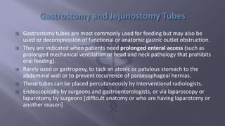 Surgical Tubes used in General Surgery