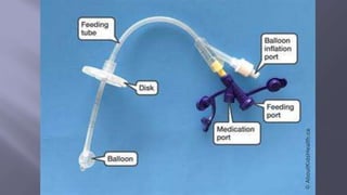 Surgical Tubes used in General Surgery