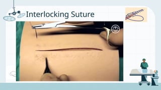 Suturing Techniques - Basic Suturing Techniques Found in the OR | PPTX