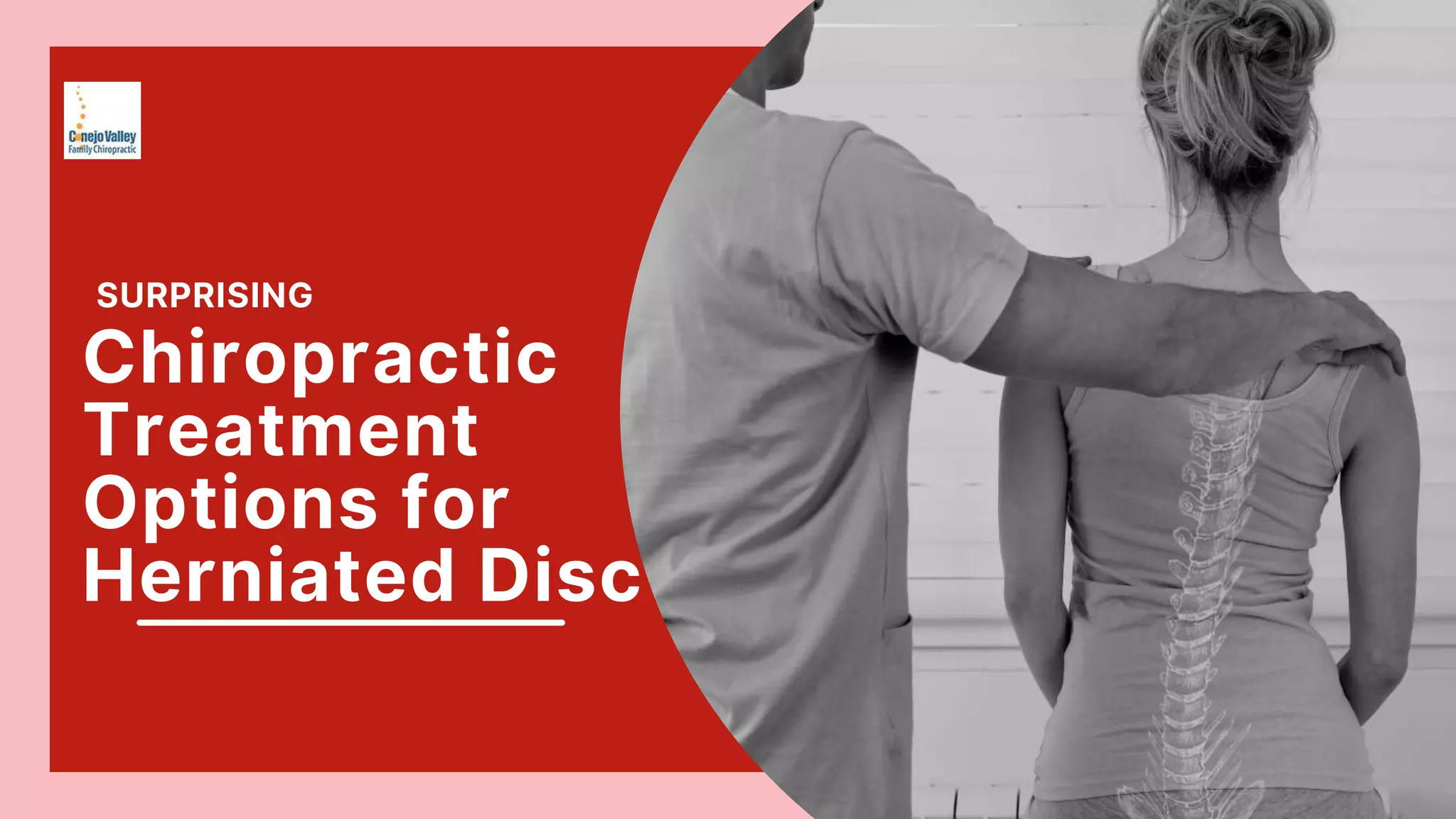 Surprising chiropractic treatment options for herniated disc ppt