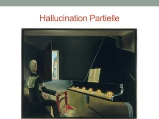 Hallucination Partielle
 