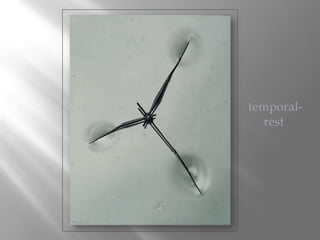 temporal-
   rest
 