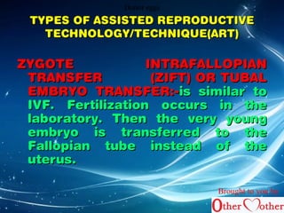 DDDooonnnooorrr eeeggggggsss 
TYPES OF AASSSSIISSTTEEDD RREEPPRROODDUUCCTTIIVVEE 
TTEECCHHNNOOLLOOGGYY//TTEECCHHNNIIQQUUEE((AARRTT)) 
ZZYYGGOOTTEE IINNTTRRAAFFAALLLLOOPPIIAANN 
TTRRAANNSSFFEERR ((ZZIIFFTT)) OORR TTUUBBAALL 
EEMMBBRRYYOO TTRRAANNSSFFEERR::--iiss ssiimmiillaarr ttoo 
IIVVFF.. FFeerrttiilliizzaattiioonn ooccccuurrss iinn tthhee 
llaabboorraattoorryy.. TThheenn tthhee vveerryy yyoouunngg 
eemmbbrryyoo iiss ttrraannssffeerrrreedd ttoo tthhee 
FFaallllooppiiaann ttuubbee iinnsstteeaadd ooff tthhee 
uutteerruuss.. 
Brought to you by 
 