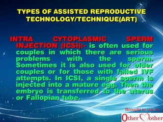TYPES OF AASSSSIISSTTEEDD RREEPPRROODDUUCCTTIIVVEE 
TTEECCHHNNOOLLOOGGYY//TTEECCHHNNIIQQUUEE((AARRTT)) 
IINNTTRRAA CCYYTTOOPPLLAASSMMIICC SSPPEERRMM 
IINNJJEECCTTIIOONN ((IICCSSII))::-- iiss oofftteenn uusseedd ffoorr 
ccoouupplleess iinn wwhhiicchh tthheerree aarree sseerriioouuss 
pprroobblleemmss wwiitthh tthhee ssppeerrmm.. 
SSoommeettiimmeess iitt iiss aallssoo uusseedd ffoorr oollddeerr 
ccoouupplleess oorr ffoorr tthhoossee wwiitthh ffaaiilleedd IIVVFF 
aatttteemmppttss.. IInn IICCSSII,, aa ssiinnggllee ssppeerrmm iiss 
iinnjjeecctteedd iinnttoo aa mmaattuurree eegggg.. TThheenn tthhee 
eemmbbrryyoo iiss ttrraannssffeerrrreedd ttoo tthhee uutteerruuss 
oorr FFaallllooppiiaann ttuubbee.. 
Brought to you by 
 