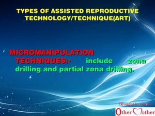TYPES OF ASSISTED REPRODUCTIVE 
TECHNOLOGY/TECHNIQUE(ART) 
MMIICCRROOMMAANNIIPPUULLAATTIIOONN 
TTEECCHHNNIIQQUUEESS::-- iinncclluuddee zzoonnaa 
ddrriilllliinngg aanndd ppaarrttiiaall zzoonnaa ddrriilllliinngg.. 
Brought to you by 
 