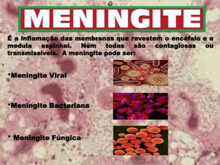 É a inflamação das membranas que revestem o encéfalo e a
medula espinhal. Nem todas são contagiosas ou
transmissíveis. A meningite pode ser:
*Meningite Viral
*Meningite Bacteriana
* Meningite Fúngica
 