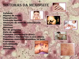 SINTOMAS da meningite
Cefaleia;
Rigidez de nuca;
Hiperpirexia;
Confusão mental;
Alteração do nível de consciência;
Vômitos;
Náuseas;
Dor de garganta;
Falta de apetite;
Fotofobia (Intolerância à luz);
Fonofobia ( Intolerância à sons altos);
Pequenas manchas vermelhas na pele;
Convulsão;
Irritabilidade;
Cansaço;
Sonolência.
 