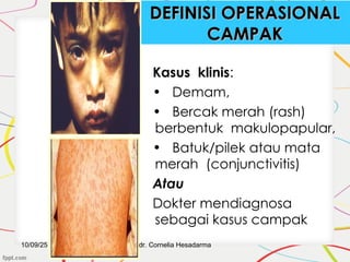 Campak Rash Surveilans penyakit potensial KLB dan WABAH.ppt