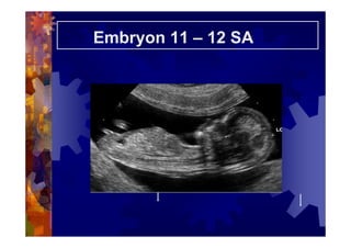 Embryon 11 – 12 SA
 