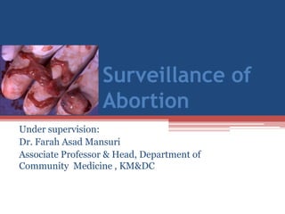 Surveillance of
                  Abortion
Under supervision:
Dr. Farah Asad Mansuri
Associate Professor & Head, Department of
Community Medicine , KM&DC
 