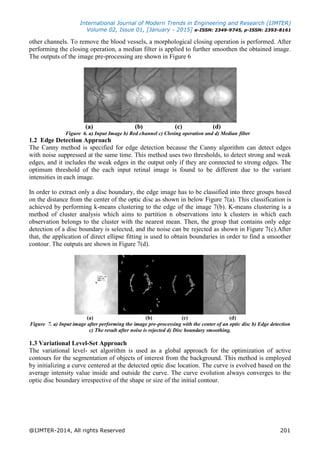 International Journal of Modern Trends in Engineering and Research (IJMTER)
Volume 02, Issue 01, [January - 2015] e-ISSN: 2349-9745, p-ISSN: 2393-8161
@IJMTER-2014, All rights Reserved 201
other channels. To remove the blood vessels, a morphological closing operation is performed. After
performing the closing operation, a median filter is applied to further smoothen the obtained image.
The outputs of the image pre-processing are shown in Figure 6
(a) (b) (c) (d)
Figure 6. a) Input Image b) Red channel c) Closing operation and d) Median filter
1.2 Edge Detection Approach
The Canny method is specified for edge detection because the Canny algorithm can detect edges
with noise suppressed at the same time. This method uses two thresholds, to detect strong and weak
edges, and it includes the weak edges in the output only if they are connected to strong edges. The
optimum threshold of the each input retinal image is found to be different due to the variant
intensities in each image.
In order to extract only a disc boundary, the edge image has to be classified into three groups based
on the distance from the center of the optic disc as shown in below Figure 7(a). This classification is
achieved by performing k-means clustering to the edge of the image 7(b). K-means clustering is a
method of cluster analysis which aims to partition n observations into k clusters in which each
observation belongs to the cluster with the nearest mean. Then, the group that contains only edge
detection of a disc boundary is selected, and the noise can be rejected as shown in Figure 7(c).After
that, the application of direct ellipse fitting is used to obtain boundaries in order to find a smoother
contour. The outputs are shown in Figure 7(d).
(a) (b) (c) (d)
Figure 7. a) Input image after performing the image pre-processing with the center of an optic disc b) Edge detection
c) The result after noise is rejected d) Disc boundary smoothing.
1.3 Variational Level-Set Approach
The variational level- set algorithm is used as a global approach for the optimization of active
contours for the segmentation of objects of interest from the background. This method is employed
by initializing a curve centered at the detected optic disc location. The curve is evolved based on the
average intensity value inside and outside the curve. The curve evolution always converges to the
optic disc boundary irrespective of the shape or size of the initial contour.
 