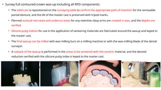 Surveyed, Milled, and Telescopic Crowns in Prosthodontics | PPTX