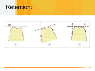 Surveying Rpd Surveyor and technique of Surveying in Removable partial denture | PPTX