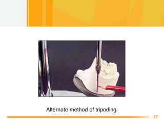 Surveyor and technique of Surveying in Removable partial denture | PPTX
