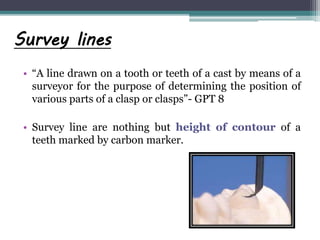 Survey lines
• “A line drawn on a tooth or teeth of a cast by means of a
surveyor for the purpose of determining the position of
various parts of a clasp or clasps”- GPT 8
• Survey line are nothing but height of contour of a
teeth marked by carbon marker.
 