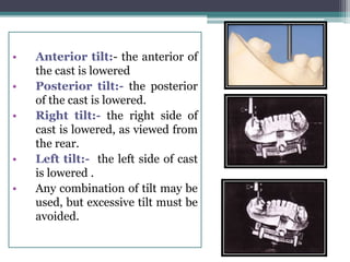 • Anterior tilt:- the anterior of
the cast is lowered
• Posterior tilt:- the posterior
of the cast is lowered.
• Right tilt:- the right side of
cast is lowered, as viewed from
the rear.
• Left tilt:- the left side of cast
is lowered .
• Any combination of tilt may be
used, but excessive tilt must be
avoided.
 