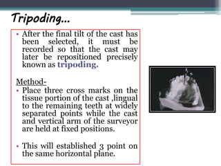 Tripoding…
• After the final tilt of the cast has
been selected, it must be
recorded so that the cast may
later be repositioned precisely
known as tripoding.
Method-
• Place three cross marks on the
tissue portion of the cast ,lingual
to the remaining teeth at widely
separated points while the cast
and vertical arm of the surveyor
are held at fixed positions.
• This will established 3 point on
the same horizontal plane.
 