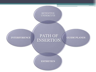 PATH OF
INSERTION
RETENTIVE
UNDERCUTS
GUIDE PLANES
ESTHETICS
INTERFERENCE
 