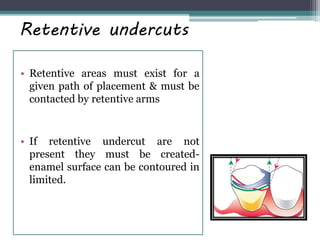 Retentive undercuts
• Retentive areas must exist for a
given path of placement & must be
contacted by retentive arms
• If retentive undercut are not
present they must be created-
enamel surface can be contoured in
limited.
 