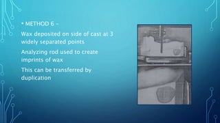 Surveying in Removable Prosthodontics | PPTX