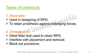 Undercut Digital Rpd Surveying | PPTX