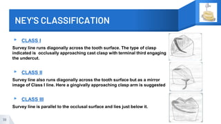 NEY'S CLASSIFICATION
▸ CLASS I
Survey line runs diagonally across the tooth surface. The type of clasp
indicated is occlusally approaching cast clasp with terminal third engaging
the undercut.
▸ CLASS II
Survey line also runs diagonally across the tooth surface but as a mirror
image of Class I line. Here a gingivally approaching clasp arm is suggested
▸ CLASS III
Survey line is parallel to the occlusal surface and lies just below it.
38
 