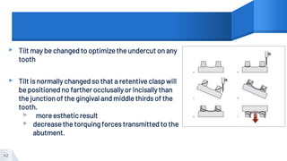 ▸ Tilt may be changed to optimize the undercut on any
tooth
▸ Tilt is normally changed so that a retentive clasp will
be positioned no farther occlusally or incisally than
the junction of the gingival and middle thirds of the
tooth.
▹ more esthetic result
▹ decrease the torquing forces transmitted to the
abutment.
42
 