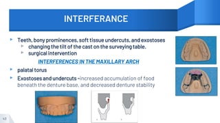 INTERFERANCE
▸ Teeth, bony prominences, soft tissue undercuts, and exostoses
▹ changing the tilt of the cast on the surveying table.
▹ surgical intervention
INTERFERENCES IN THE MAXILLARY ARCH
▸ palatal torus
▸ Exostoses and undercuts -increased accumulation of food
beneath the denture base, and decreased denture stability
43
 
