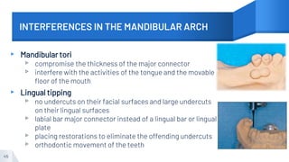 INTERFERENCES IN THE MANDIBULAR ARCH
▸ Mandibular tori
▹ compromise the thickness of the major connector
▹ interfere with the activities of the tongue and the movable
floor of the mouth
▸ Lingual tipping
▹ no undercuts on their facial surfaces and large undercuts
on their lingual surfaces
▹ labial bar major connector instead of a lingual bar or lingual
plate
▹ placing restorations to eliminate the offending undercuts
▹ orthodontic movement of the teeth
45
 