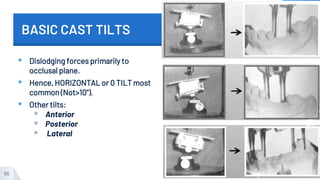 BASIC CAST TILTS
▸ Dislodging forces primarily to
occlusal plane.
▸ Hence, HORIZONTAL or 0 TILT most
common (Not>10").
▸ Other tilts:
▹ Anterior
▹ Posterior
▹ Lateral
55
 