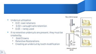 ▸ Undercut utilization
▹ 0.01 -cast retainers
▹ 0.02-> wrought wire retention
▹ 0.03 — rarely used
▸ If no retentive undercuts are present, they must be
created by
▹ Gold Crowns
▹ Retentive Restorations
▹ Creating an undercut by tooth modification
59
 