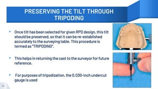 PRESERVING THE TILT THROUGH
TRIPODING
▸ Once tilt has been selected for given RPD design, this tilt
should be preserved, so that it can be re-established
accurately to the surveying table. This procedure is
termed as "TRIPODING".
▸ This helps in returning the cast to the surveyor for future
reference.
▸ For purposes of tripodization, the 0.030-inch undercut
gauge is used
61
 